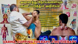 அனைத்து நோய்களையும் குணப்படுத்தும் அதிசயம் | VARMA MARUTHUVAM, CUPPING THERAPHY | Nanga Romba Busy