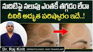 నుదిటిపై నలుపుకు పరిష్కారం | Forehead Pigmentation Telugu | Celestee Skin And Hair Clinic