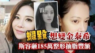 斯容砸185萬整形60次 削骨抽脂豐額，想變金泰希