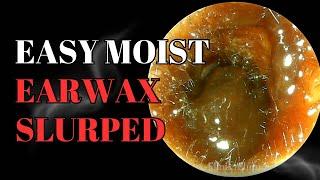 Easy Moist Earwax Slurped