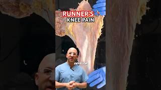 Runner’s Knee Pain Fix ‍️ #shorts