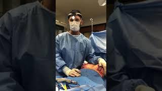 Breast Implant Removal and Revision by Dr. Michael Rossi