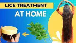 lice treatment at home | जूओं व लिखों से छूटकारा पाए #shorts #hairstyle #thesoni #hair