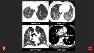 Emergency Radiology Case of the Day 11