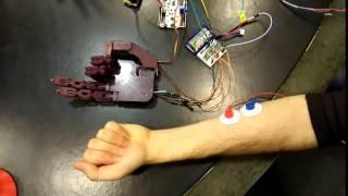 Myoelectric control of the Dextra robotic hand