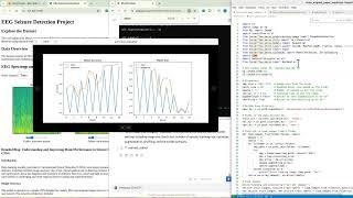 Tracking Model Training Time, Augmentation Effects & Misclassification Insights in Machine Learning