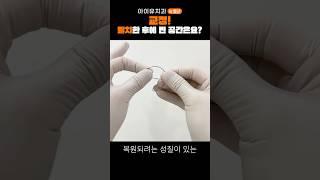 교정할 때 치아는 어떻게 가지런해질까? #shrots