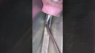 Аргоновая сварка Tig сварка Аргоном Угловая сварка