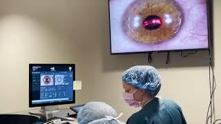 Live PRK Procedure at Commonwealth Eye Surgery