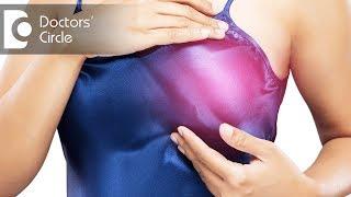 What causes pimple near nipple area in women of 20's & its management? - Dr. Rasya Dixit