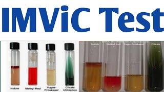 IMViC Test | Indole, Methyl red, Voges-proskauer, Citrate Test #jitendrapatel #imvictest