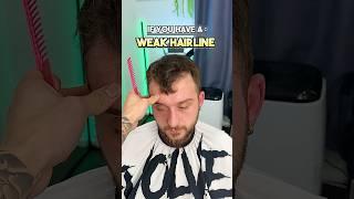 If you have a weak hairline | watch this 