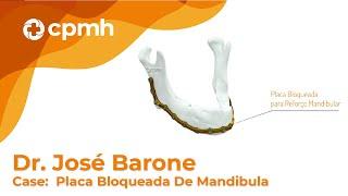 Dr. José Barone - Case com Placa Bloqueada de Mandibula