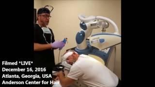 Techniques in ARTAS Robotic Hair Transplant Surgery - How to Achieve tension