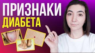 Как Выявить и НАВСЕГДА ВЫЛЕЧИТЬ Сахарный Диабет!