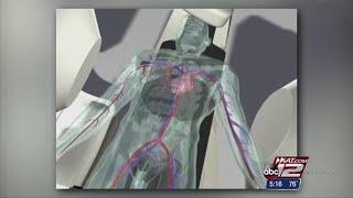 VIDEO: Robotic Surgery for AFib