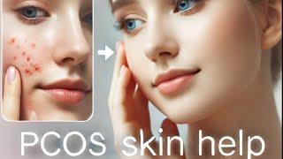 PCOS & Skin: Effective Tips to Manage Acne, Dark Patches, and Hair Issues!