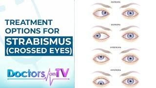 Strabismus In Other Perspective