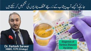 Urine & Diagnosis Of Various Diseases | پیشاب کے زریعے بیماریوں کی تشخیص | By Dr. Fartash Sarwar