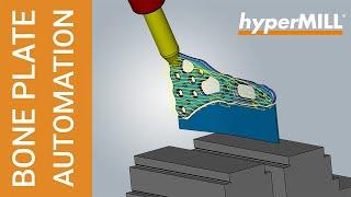 hyperMILL AUTOMATION CENTER: Bone Plate CAD/CAM Automation Use Case