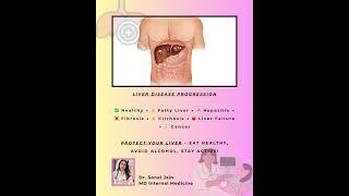 Stages of Liver Disease | Protect Your Liver by Dr. Sonal Jain @drsonaljain85