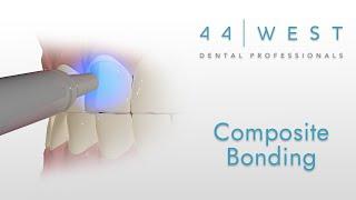 Composite Bonding | Grandville Dentist | 44 West Dental Professionals