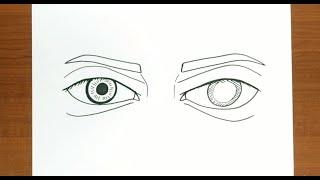 How to Draw CATARACT EYE ILLUSTRATION