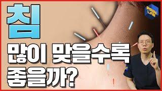 침은 많이 맞을수록 좋을까?? | 침술의 용량 (acupuncture)과 효과에 관하여 | 도침 시술