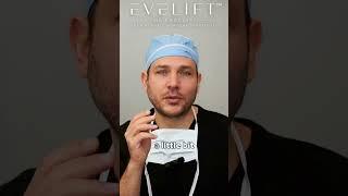 EVE Lift™ with Extended Necklift Before and After | Eden Plastic Surgery: Dr. Ali Charafeddine, MD