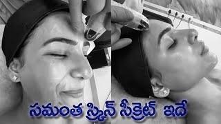 Actress Samantha Reveals Her Glowing Skin Secret | Vitamin Infusion Therapy | IG Telugu