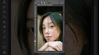 How to Face Acne Removed | Photoshop Skin Retouch 2025 Tutorial #Shorts