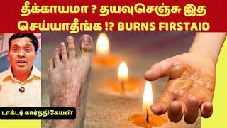 தீக்காயமா? தயவுசெஞ்சு இத செய்யாதீங்க ! 18 first aid treatment tips