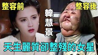 明明天生麗質，卻非要整容成「僵屍臉」，不知道這些女星照鏡子的時候，有沒有後悔？#邵音音#韓慧景#鄭裕玲#楊怡#傅明憲#邵音音#李嘉欣#李彩樺#黎姿#薛芷倫#郭可盈#楊麗菁 #星聞榜