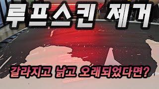 루프스킨 제거 고민중 입니까?