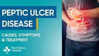 Your guide to peptic ulcer disease