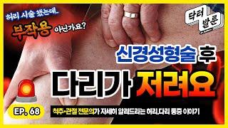 【허리】 신경성형술 시술까지 했는데, 다리가 저리다고요? 내가 알려줄게! 구독자Q&Aㅣ닥발TV