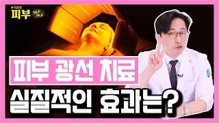 '통증 없이 효과는 좋다?' 적외선, 자외선, 가시광선, FSL 등 다양한 광선 치료 종류별 특징과 효과는? - 박치영의 피부 톡톡 #104