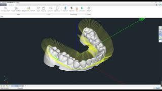 CAM Operation DEMO by Zhiyin Dental