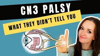 Cranial Nerve 3 Palsy Explained (High Definition Version)