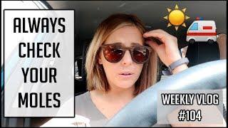 ALWAYS CHECK YOUR MOLES! | xameliax Weekly Vlog #104