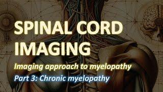 Imaging of the Spinal Cord (3): Chronic myelopathy