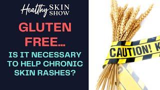 GLUTEN FREE: Necessary To Stop Eczema, Psoriasis, Or Other Rashes? | Jennifer Fugo