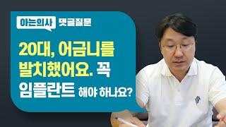 20대, 꼭 임플란트가 정답일까? 어금니 하나 없어도 괜찮지 않을까? 85세 임플란트 가능할까?