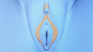 Labiaplasty Procedure explained video by Dr  Mark Lowney