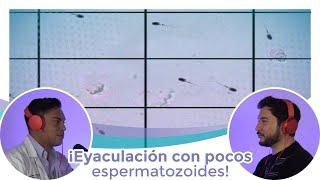 POCOS ESPERMATOZOIDES