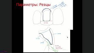 "Методики препарирования зубов под цельнокерамические реставрации."(18.06.2019)