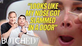 BEFORE & AFTER: Life-Changing Botched Nose Jobs | Botched | E!