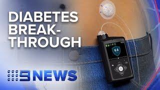 Medical breakthrough for diabetes patients | Nine News Australia