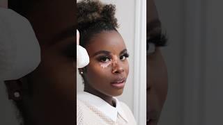 Soft Glam Makeup Tutorial #vitiligobeauty #makeuptutorial #softglamlook #doseofjass