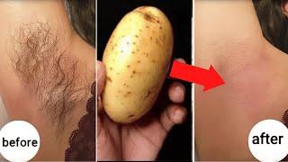 stop shaving! here s how to permanently get rid of facial, body and pubic hair